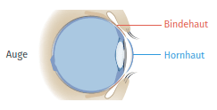 Grafik des Auges mit Bindehaut, Hornhaut und Auge.